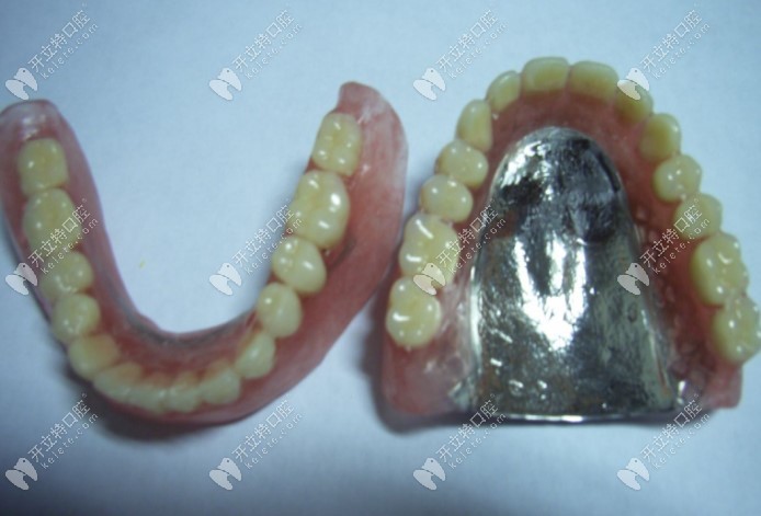 全口钴铬合金假牙:4000元起 全口钛合金义齿:6000元起 全口纯钛义齿