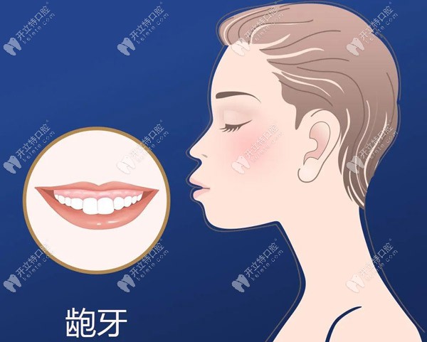 上海华美口腔做龅牙矫正的技术如何