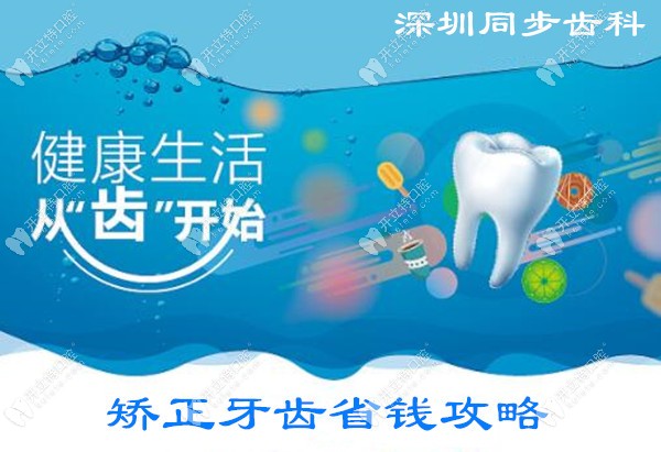 深圳同步齿科牙齿矫正优惠活动