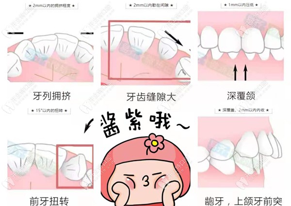 美加牙套适应症有哪些