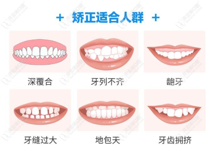 武汉牙达人口腔医院可以做的牙畸形矫正