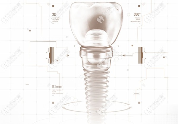 常州北極星口腔種植牙怎么樣