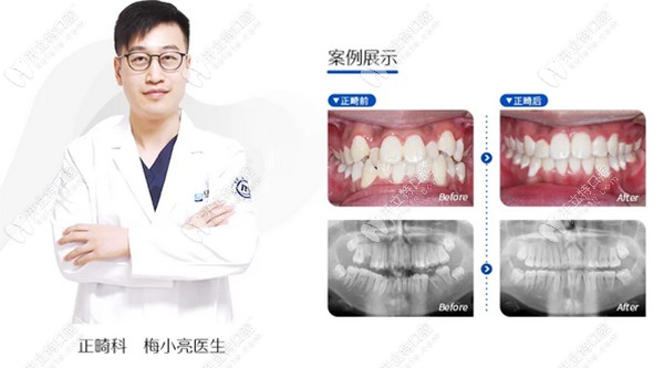 南通美奧口腔正畸科醫(yī)生梅小亮