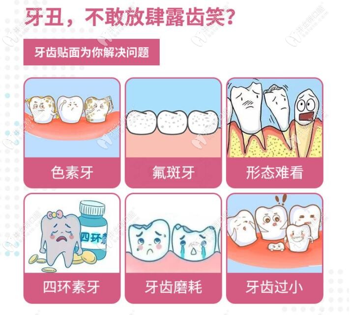 雅医家口腔的牙齿贴面可以解决这些问题