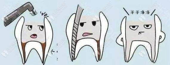 做过根管后牙齿没有牙神经