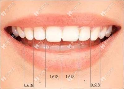 牙齿的微笑曲线设计