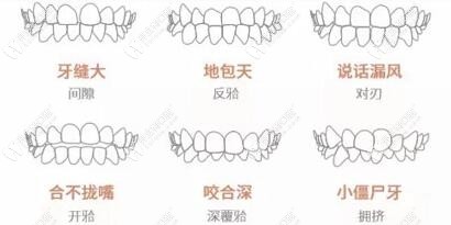 你的牙齿是什么症状