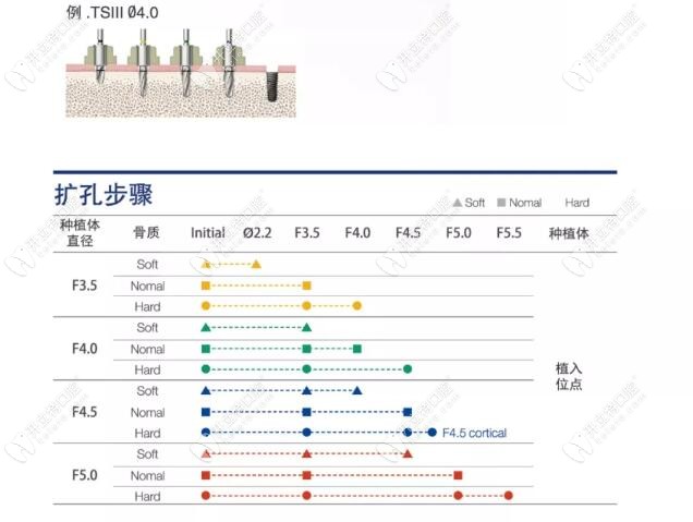 不同的扩弓步骤