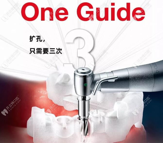 韩国奥齿泰OneGuide种牙技术:扩孔只需要三次