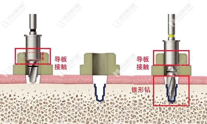 导板接触情况