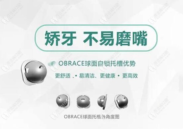 OBrace球面自锁托槽优点