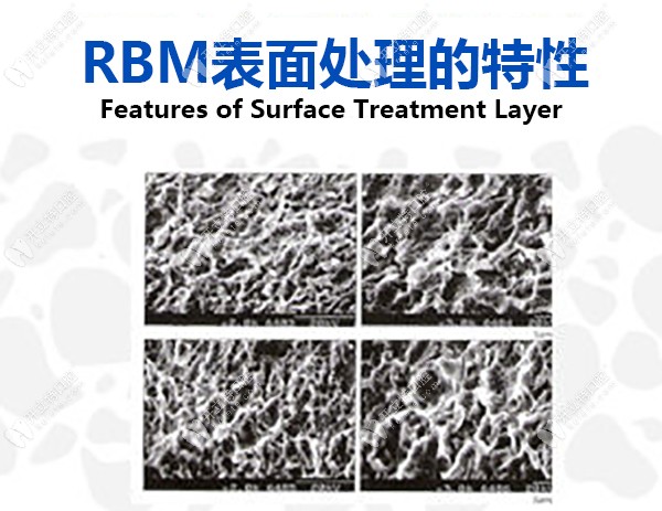 RBM表面处理的特性