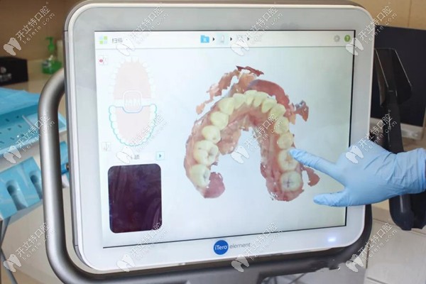 牙博士在牙齿矫正上有独特的技术