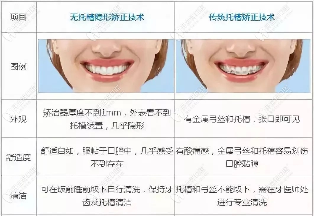 隐形牙套和钢丝牙套对比