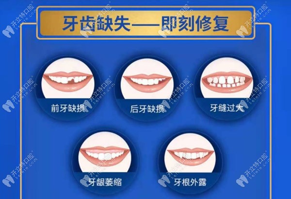 牙齿缺失可以选择即刻修复技术