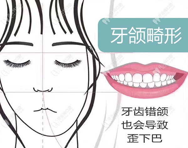 牙齿畸形会影响健康