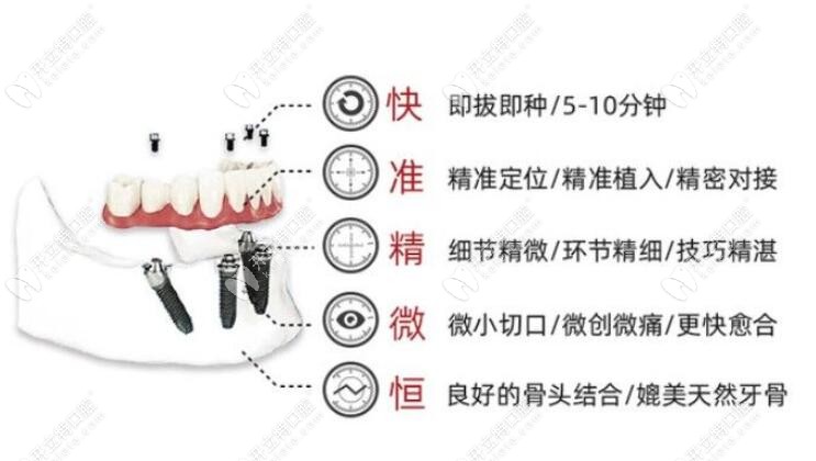 ALL-ON-6种植牙的优势