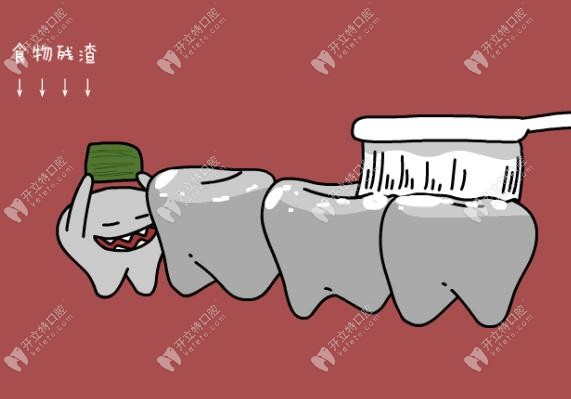 为什么每天好好刷牙还得牙周炎,这些牙周预防措施快揣兜
