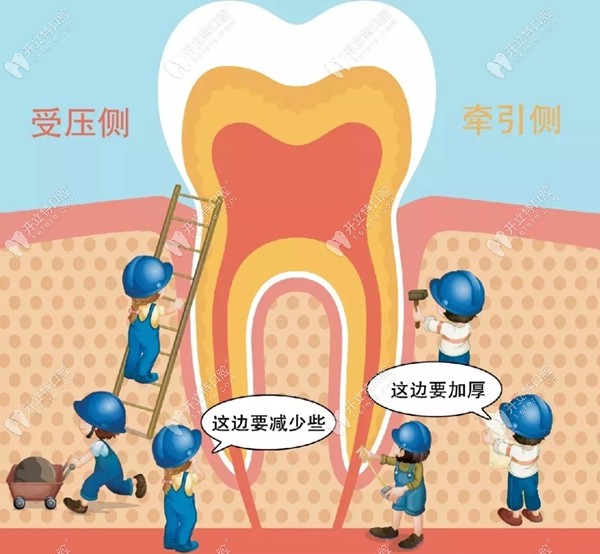 正畸过程中牙齿合理的移动速度是1毫米