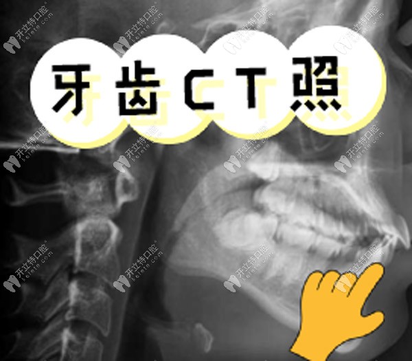 正常的牙齿咬合CT 图图片