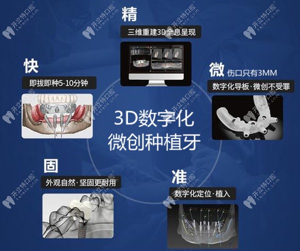 维港口腔3D数字化微创种植牙技术优势