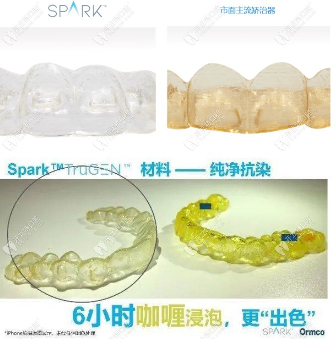 相对比其他牙套，spark的抗染色能力更强