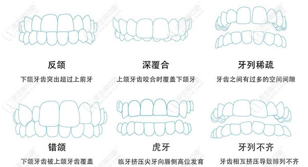 罗缘口腔可以做的牙齿畸形矫正