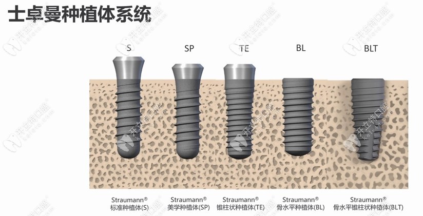 瑞士士卓曼种植体分几种