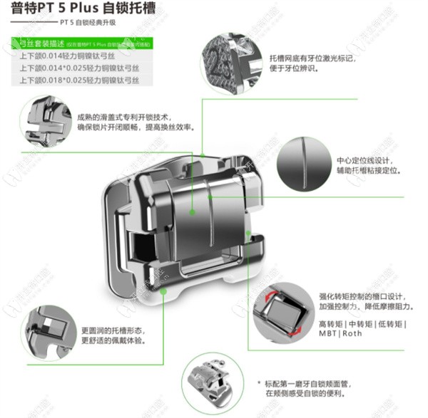 普特PT 5Plus自锁托槽