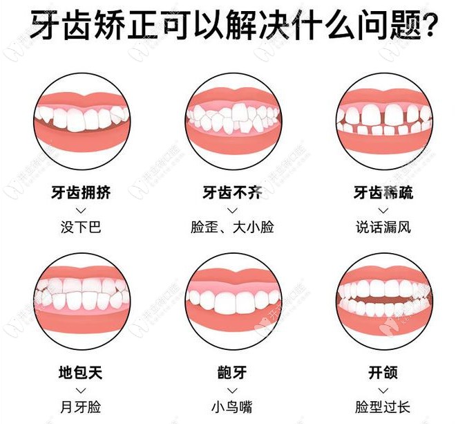 眾仁口腔牙齒矯正 眾仁口腔牙齒矯正