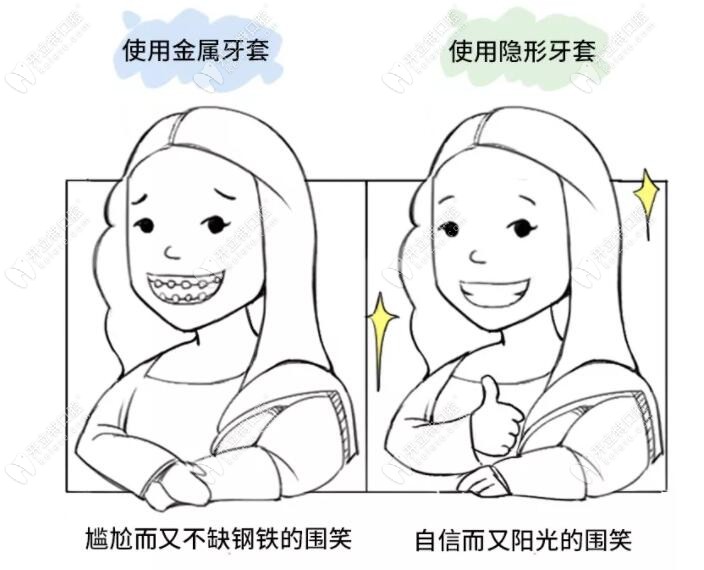 金屬牙套和隱形牙套的區(qū)別