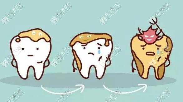 牙根松动的患牙不需要拔掉