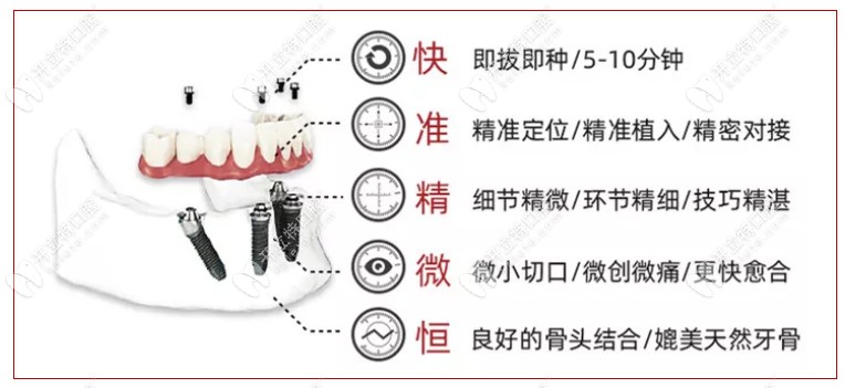 昆明柏德口腔数字化种植牙的优势