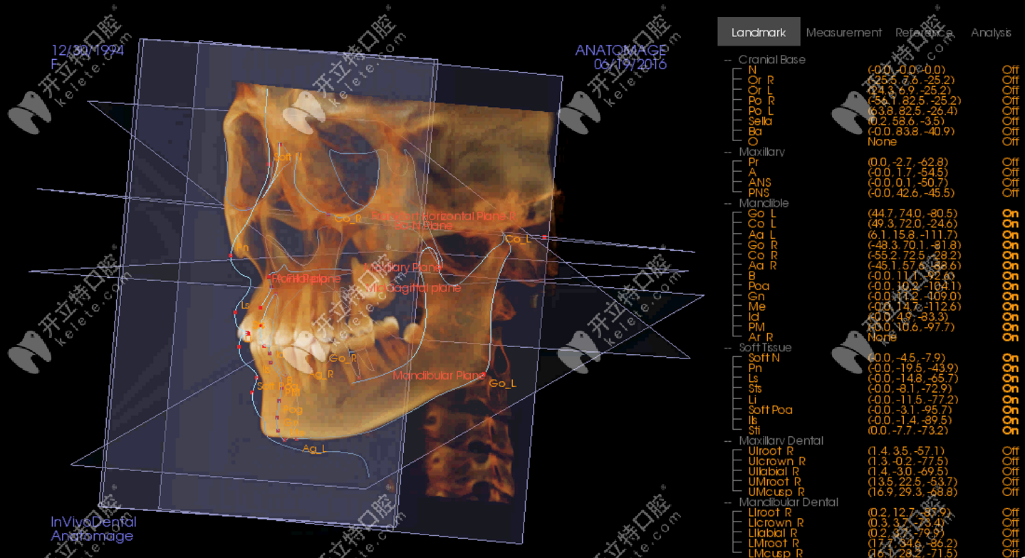 柏德牙科3D数字化正畸技术
