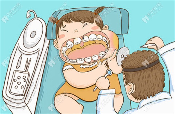牙周炎治疗各步骤一般要多少钱