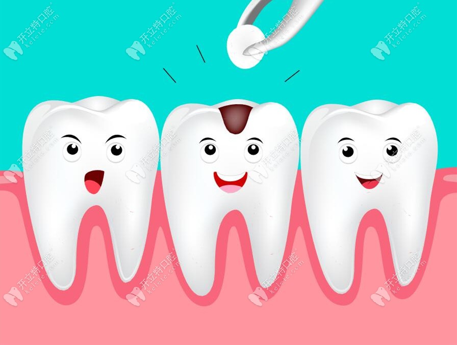 为什么补的牙容易掉?如果补牙材料掉了一定要马上补回去吗