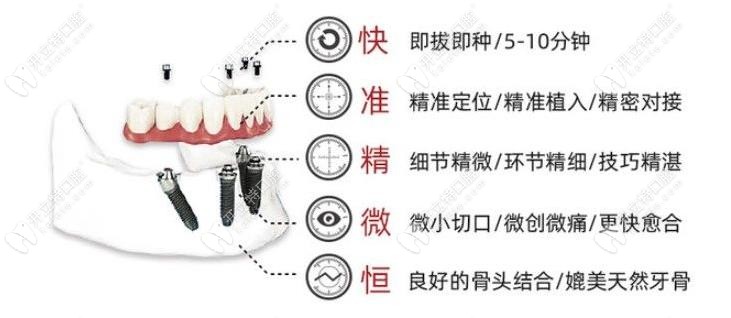 即刻负重种植技术优势