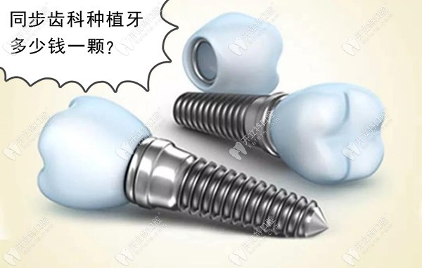 深圳同步齿科种植牙多少钱一颗,据说3~4千元可做韩国奥齿泰