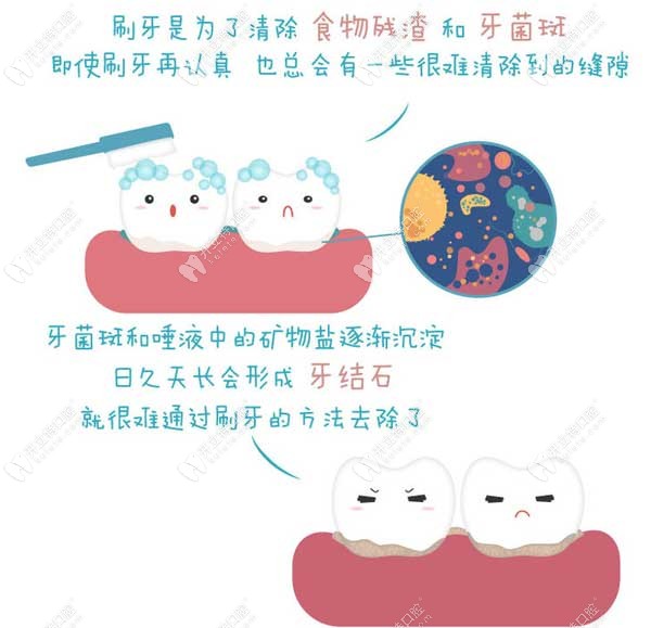 刷牙是为了清除食物残渣和牙菌斑