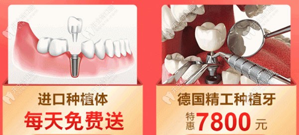 广州中家医口腔种植牙优惠