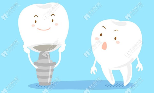 锦江贝臣齿科所拥有的种植牙技术
