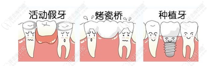 牙齿缺失的三种修复方式
