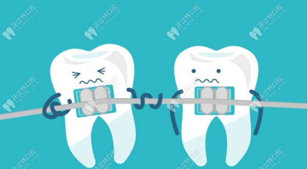 牙齿不齐会导致牙周炎