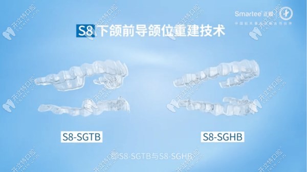 正雅S8-SGTB/HB矫正器能导下颌骨向前后移,下巴后缩不用正颌啦