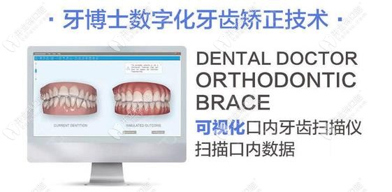 牙博士数字化牙齿矫正技术