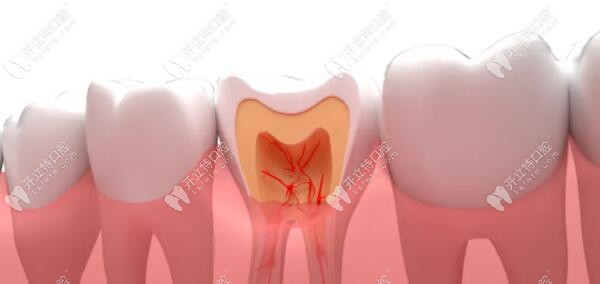 孩子乳牙做根管治疗会影响恒牙的萌出或牙体质量吗？