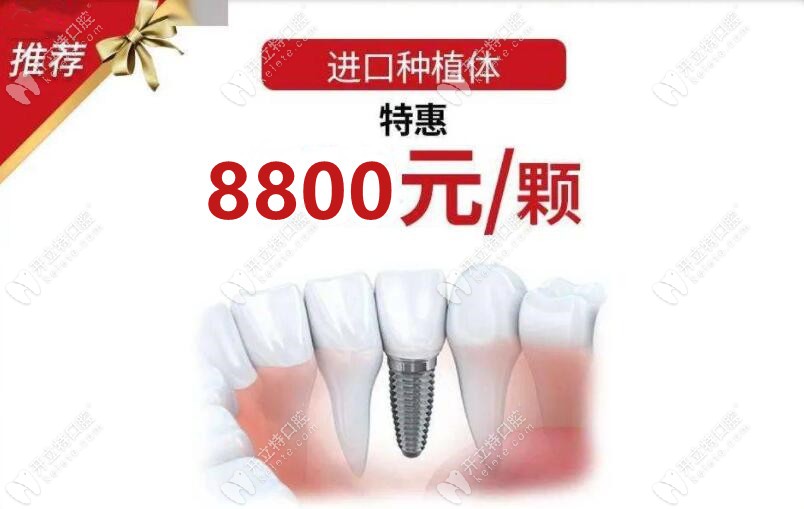 杭州富阳口腔优惠活动出了:瑞典诺贝尔PMC种植牙价格降到8.8k