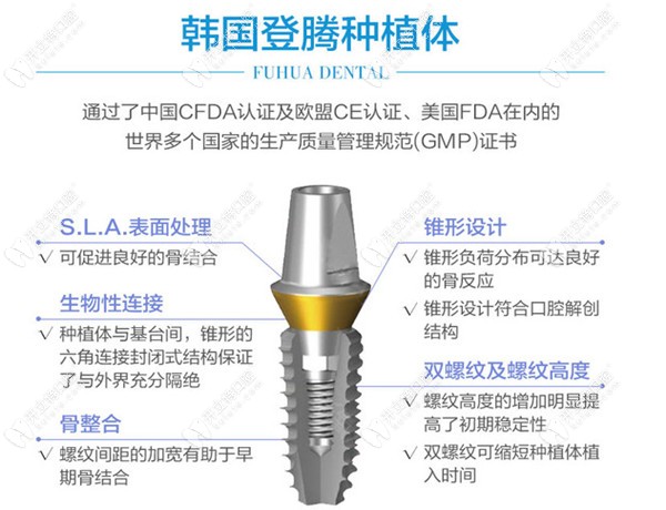 韩国登腾种植体优势