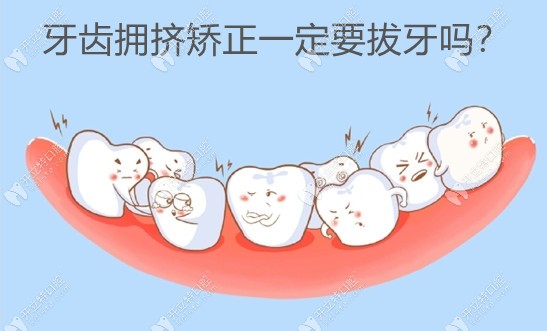 谁说牙齿拥挤矫正要拔牙?这几种方法说正畸也可以不用拔牙