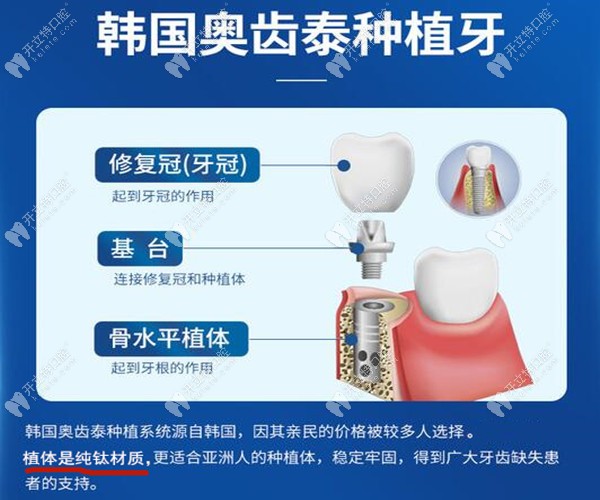 深圳正恩口腔韩国奥齿泰种植牙